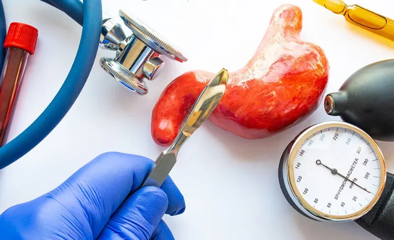 A gloved hand holding a scalpel near a model of the stomach, surrounded by medical tools like a stethoscope, blood sample, and pressure gauge.