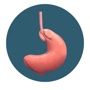 A stomach attached to the esophagus after surgical stitching near the upper part of the stomach.