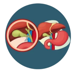 The gallbladder and bile duct near the liver, with a close-up view showing a surgical instrument working on the bile duct.